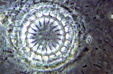  (Trichodina)