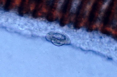  (Trichodina)