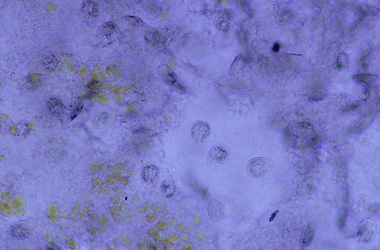  (Chilodonella)