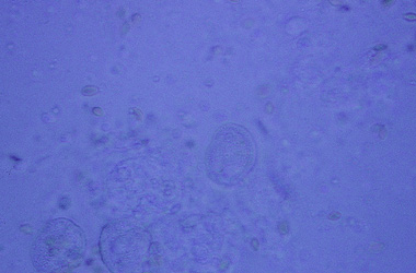  (Chilodonella)