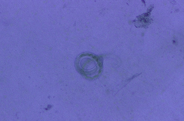 Nematoda () -   