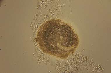   (Ichthyophthirvus multifiliis)