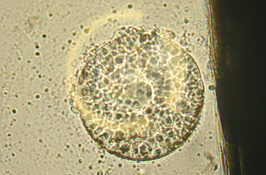   (Ichthyophthirvus multifiliis)