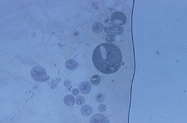   (Ichthyophthirvus multifiliis)